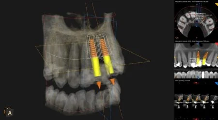 Dental Dental 3D CT Scans at Market Place Dentistry Thirsk